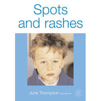 Spots and Rashes Books Ana Wiz   